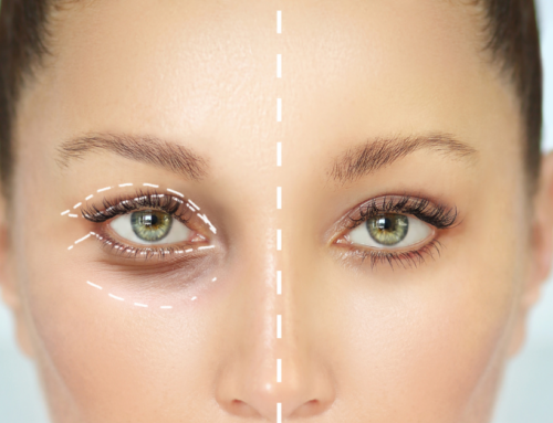 How Much Does an Eyelid Surgery Cost?